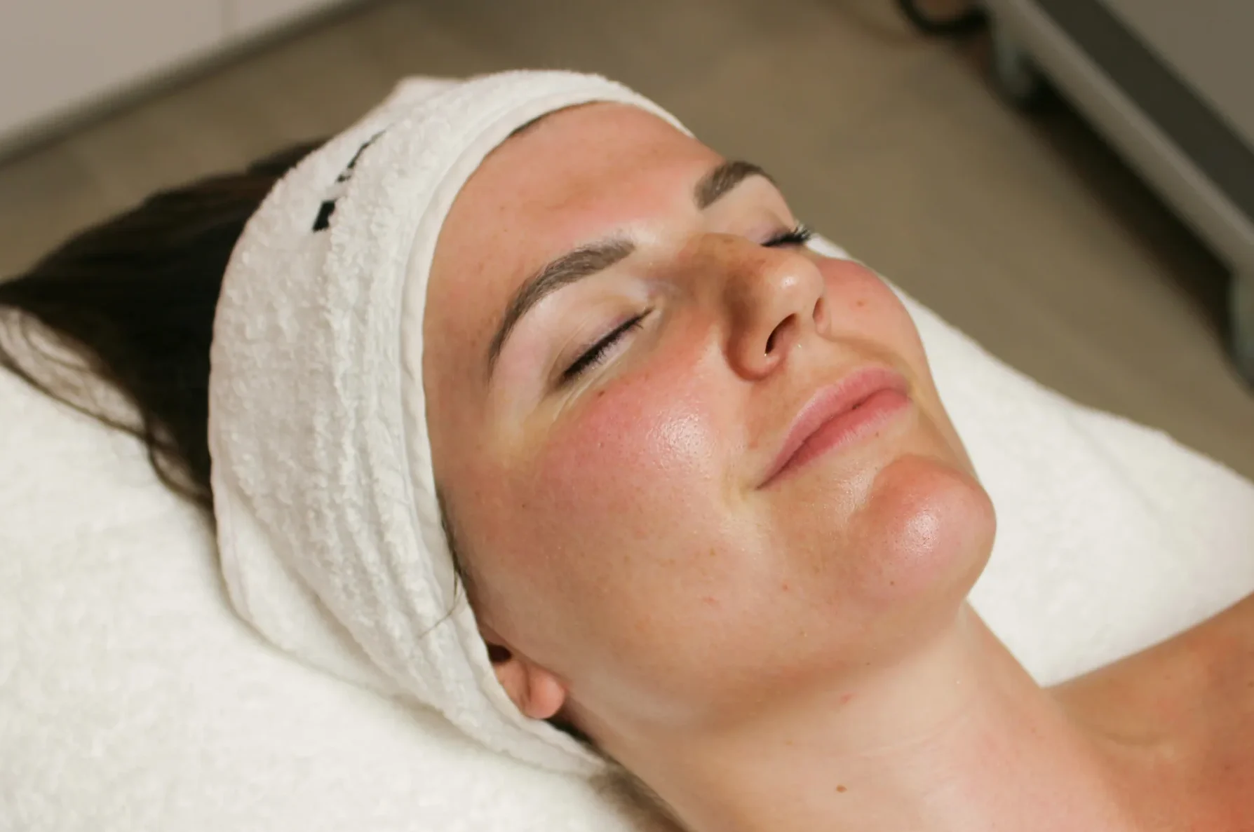 Resultaat grove porien (na) 1