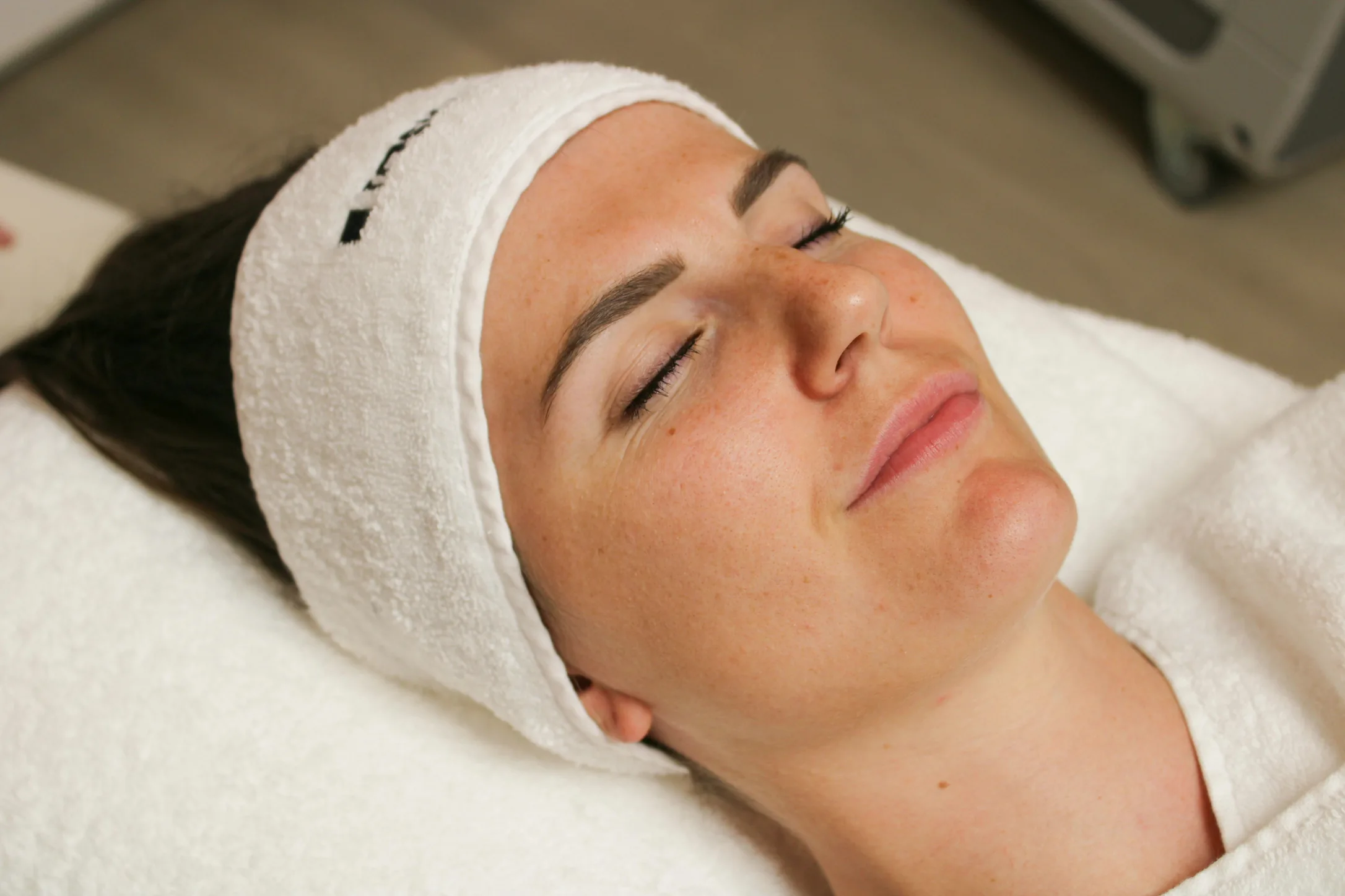 resultaat grove poriën (voor) 1